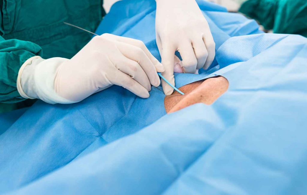 Medical Devices